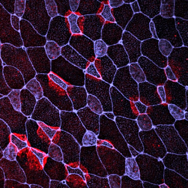 Immunofluorescent image of cultured ionocytes labeled with DSHB antibody IVF12 against SLC4A1, anion exchanger 1 (red). Image Credit: Brian Mitchell, Northwestern University.